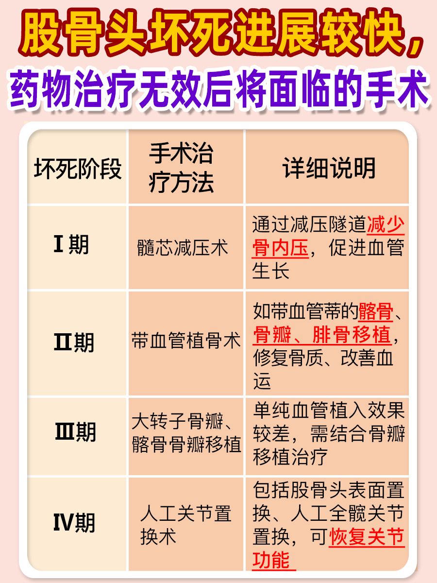 股骨头坏死最新药物，希望之光的故事